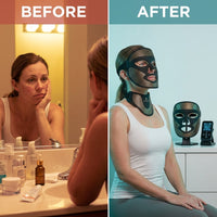 Aurarae Halo+ Pro LED Therapy Mask Set — Before & After